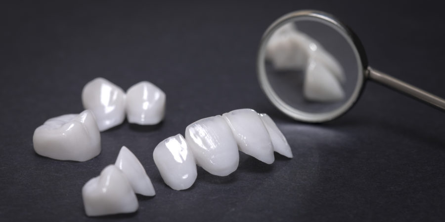 Zahnarzt Bonn - Ippendorf, Kessenich, Poppelsdorf, Röttgen- Dentale Kosmetik